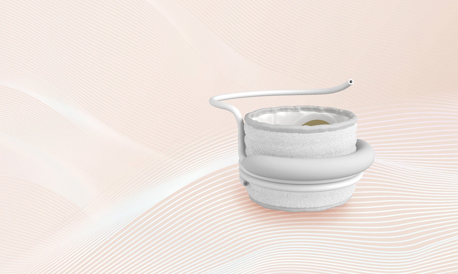 TMVR with the SAPIEN M3 System | Edwards Lifesciences